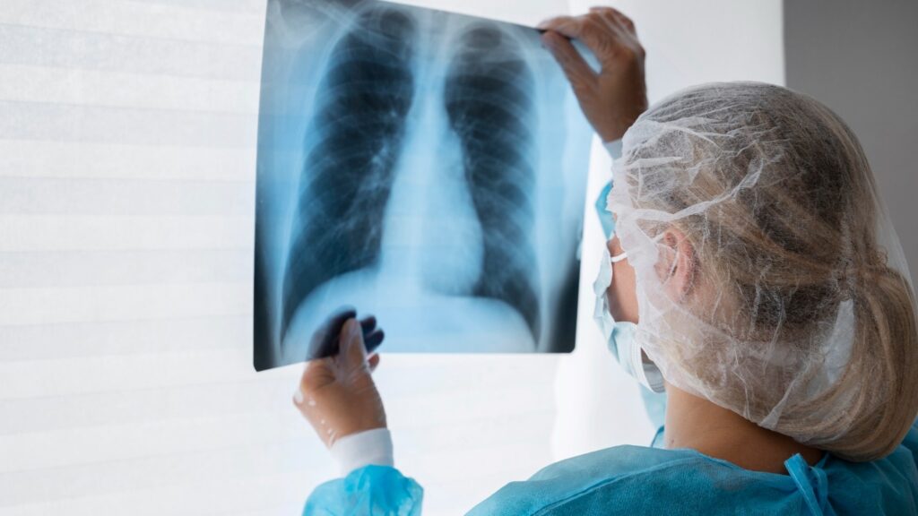 Cáncer de pulmón: Conoce sus síntomas